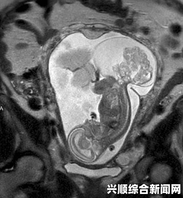 巫师3狂猎，突变诱发物的获取方法