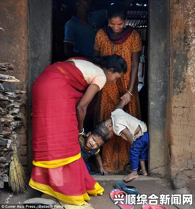 印度连体兄弟各自拥有独立上半身，独特生活体验与基本自理能力（图文）