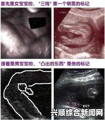 印度一女子宫外孕长达36年，胎儿仅留一副骸骨，医学奇迹与生命之谜