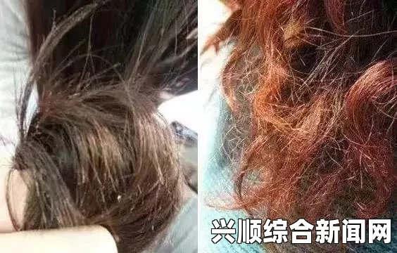英一女孩头发长满虱子，触目惊心的现实挑战